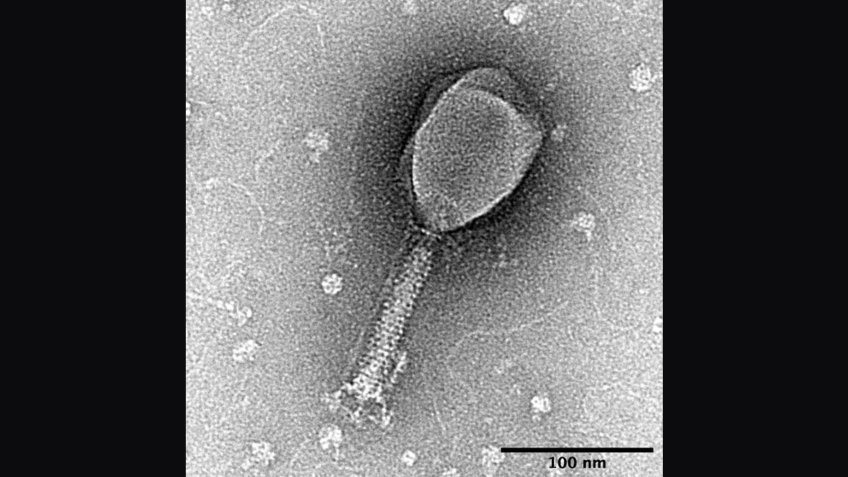 Black and white electron micrograph of a single T2 bacteriophage, with a rounded head, a long striped tail and a 100 nanometre scale bar in the corner